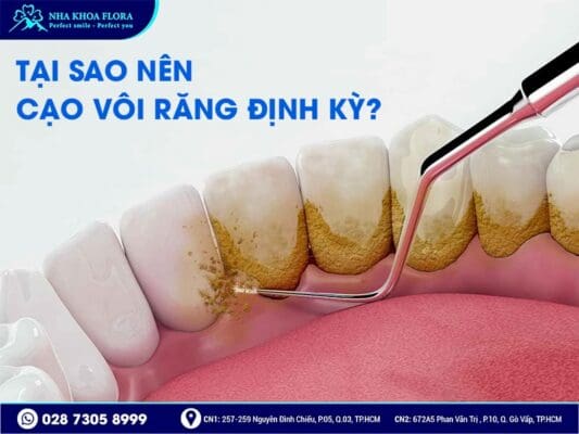 cạo vôi răng có đau không - ảnh 1 cạo vôi răng có đau không - ảnh 1