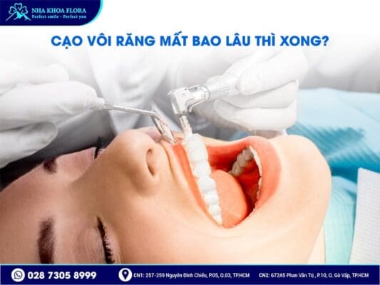 Cạo vôi răng có làm trắng răng không - ảnh 3 Cạo vôi răng có làm trắng răng không - ảnh 3