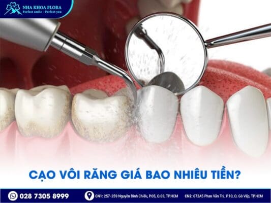 Cạo vôi răng giá bao nhiêu - ảnh 1 Cạo vôi răng giá bao nhiêu - ảnh 1