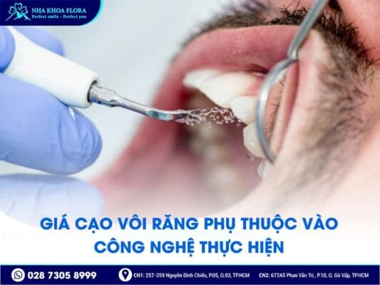 Cạo vôi răng giá bao nhiêu - ảnh 2 Cạo vôi răng giá bao nhiêu - ảnh 2