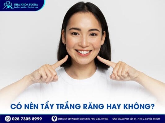 có nên tẩy trắng răng - ảnh 1 có nên tẩy trắng răng - ảnh 1