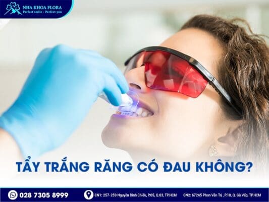 có nên tẩy trắng răng - ảnh 3 có nên tẩy trắng răng - ảnh 3