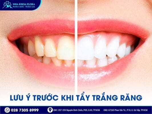 có nên tẩy trắng răng - ảnh 4 có nên tẩy trắng răng - ảnh 4