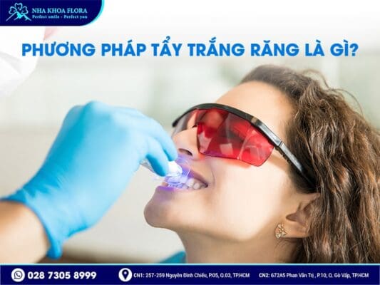 Tẩy trắng răng có hại không - ảnh 1 Tẩy trắng răng có hại không - ảnh 1