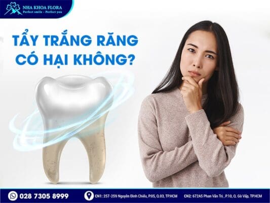 Tẩy trắng răng có hại không - ảnh 2 Tẩy trắng răng có hại không - ảnh 2