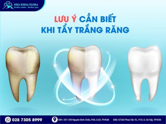 Tẩy trắng răng có hại không - ảnh 5 Tẩy trắng răng có hại không - ảnh 5