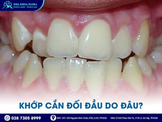 khớp cắn đối đầu - ảnh 2 khớp cắn đối đầu - ảnh 2