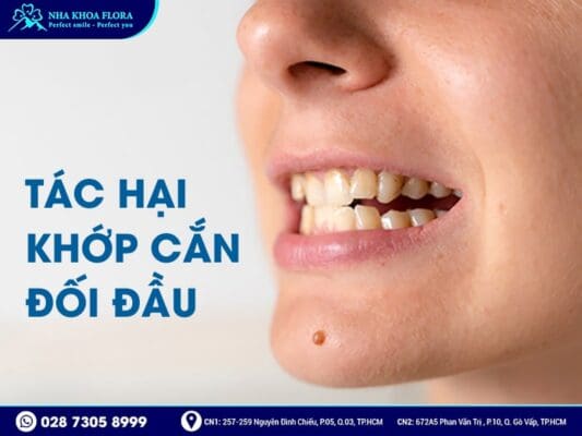 khớp cắn đối đầu - ảnh 3 khớp cắn đối đầu - ảnh 3