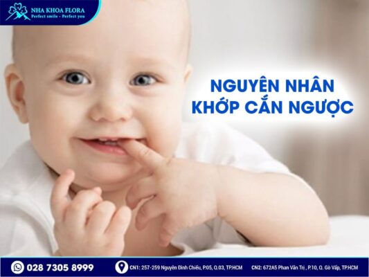 khớp cắn ngược - ảnh 2 khớp cắn ngược - ảnh 2