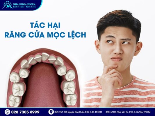 răng cửa mọc lệch - ảnh 3 răng cửa mọc lệch - ảnh 3