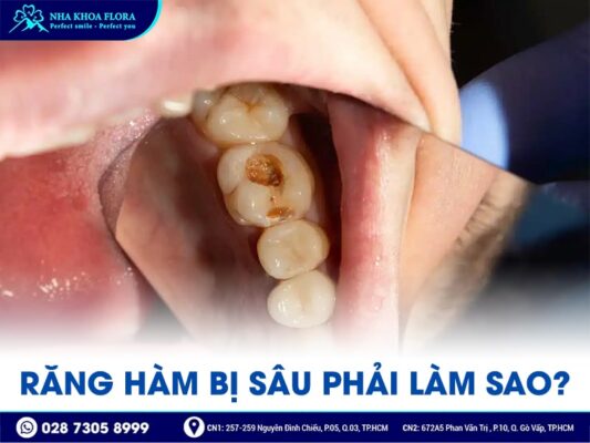 răng hàm có thay không - ảnh 3 răng hàm có thay không - ảnh 3