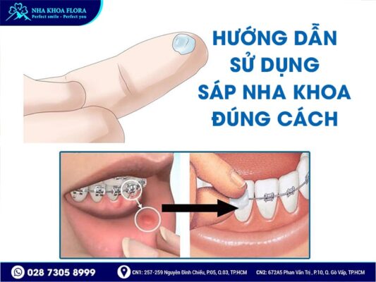 sáp nha khoa - ảnh 3 sáp nha khoa - ảnh 3