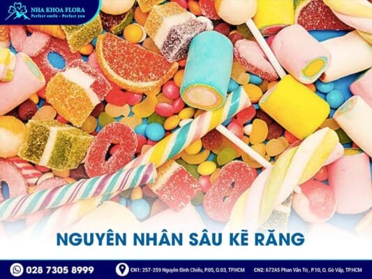 sâu kẽ răng - ảnh 3 sâu kẽ răng - ảnh 3