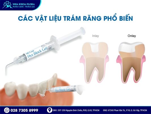 Trám răng bao nhiêu tiền - ảnh 4 Trám răng bao nhiêu tiền - ảnh 4
