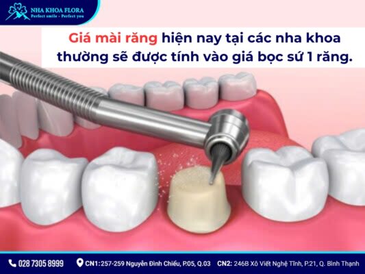 mài răng bọc sứ - ảnh 5 mài răng bọc sứ - ảnh 5