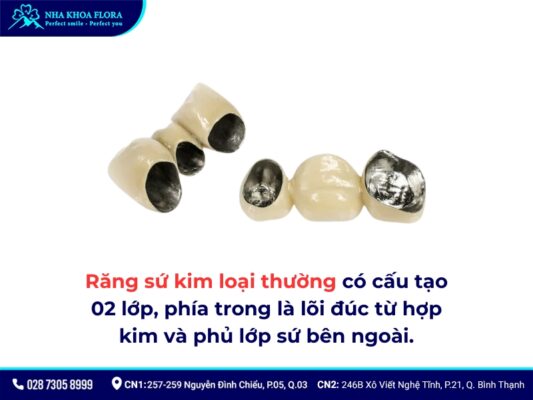 Bọc răng sứ kim loại được bao lâu? - ảnh 1 Bọc răng sứ kim loại được bao lâu? - ảnh 1