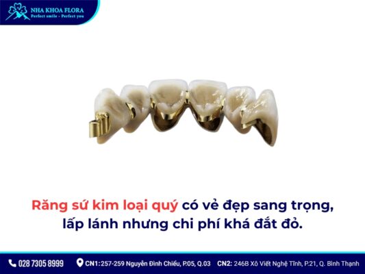 Bọc răng sứ kim loại được bao lâu? - ảnh 3 Bọc răng sứ kim loại được bao lâu? - ảnh 3