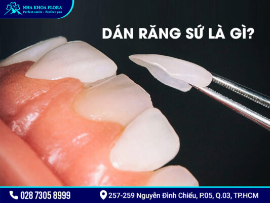 Dán răng sứ có tốt không? - ảnh 1 Dán răng sứ có tốt không? - ảnh 1