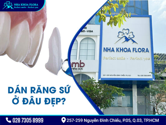 Dán răng sứ có tốt không? - ảnh 4 Dán răng sứ có tốt không? - ảnh 4