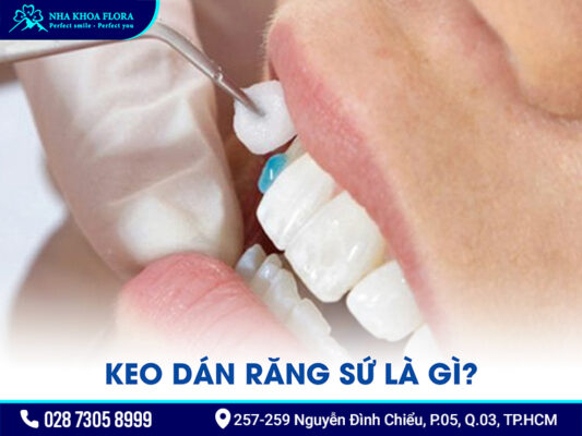 Keo dán răng sứ - ảnh 1 Keo dán răng sứ - ảnh 1
