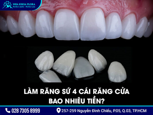 Làm răng sứ 4 răng cửa - ảnh 3 Làm răng sứ 4 răng cửa - ảnh 3