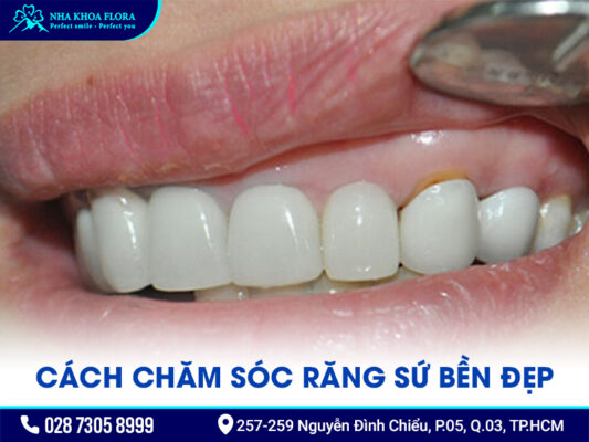 làm răng sứ bị thâm nướu - ảnh 4 làm răng sứ bị thâm nướu - ảnh 4