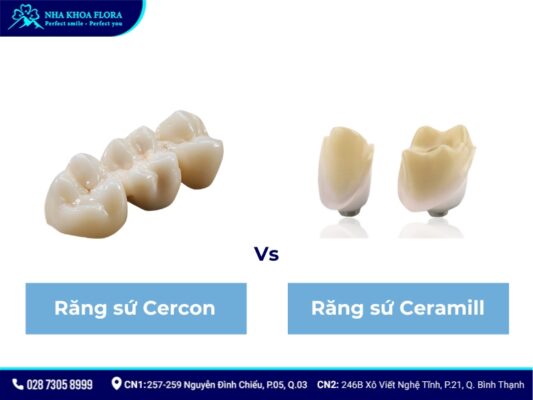Răng sứ Ceramill - ảnh 7 Răng sứ Ceramill - ảnh 7