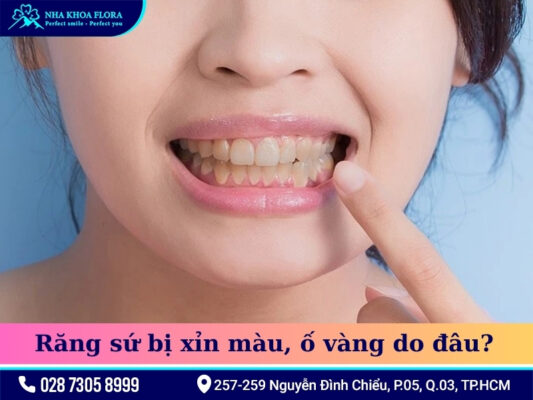Răng sứ có tẩy trắng được không - ảnh 2 Răng sứ có tẩy trắng được không - ảnh 2