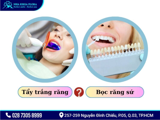 Răng sứ có tẩy trắng được không - ảnh 5 Răng sứ có tẩy trắng được không - ảnh 5