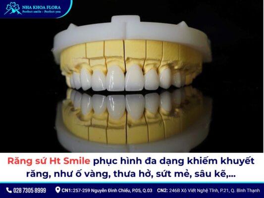 răng sứ Ht Smile - ảnh 2 răng sứ Ht Smile - ảnh 2