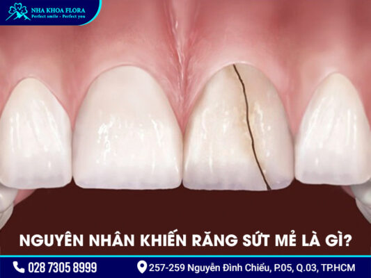 Răng sứt - ảnh 1 Răng sứt - ảnh 1