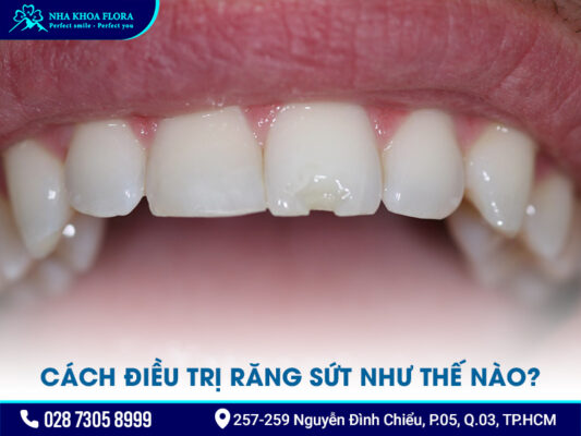 Răng sứt - ảnh 2 Răng sứt - ảnh 2