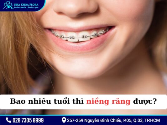 20 tuổi niềng răng bao lâu - ảnh 1 20 tuổi niềng răng bao lâu - ảnh 1