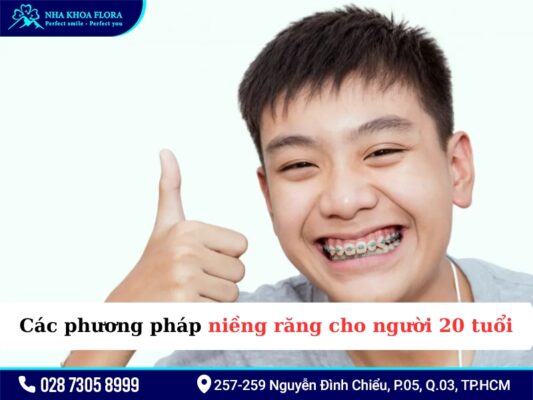 20 tuổi niềng răng bao lâu - ảnh 3 20 tuổi niềng răng bao lâu - ảnh 3