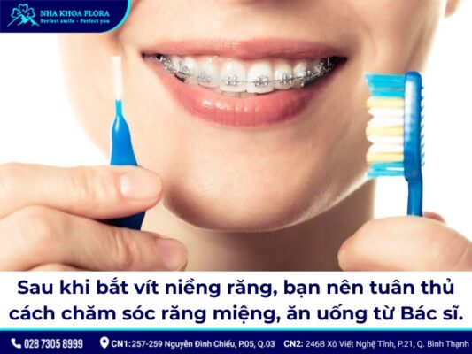 Bắt vít niềng răng - ảnh 6 Bắt vít niềng răng - ảnh 6