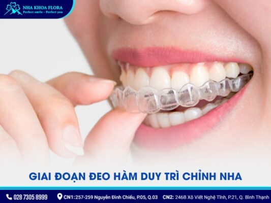 các giai đoạn niềng răng - ảnh 3 các giai đoạn niềng răng - ảnh 3