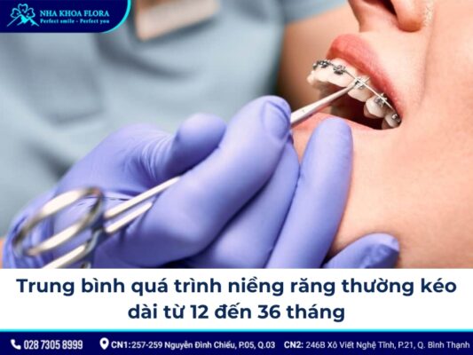 các giai đoạn niềng răng - ảnh 6 các giai đoạn niềng răng - ảnh 6