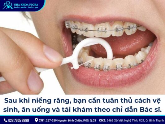 các giai đoạn niềng răng - ảnh 7 các giai đoạn niềng răng - ảnh 7