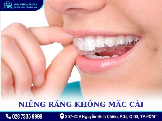 Các kiểu niềng răng - ảnh 3 Các kiểu niềng răng - ảnh 3