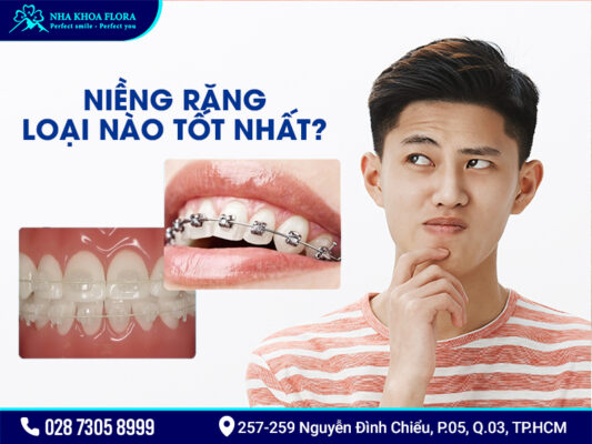 Các kiểu niềng răng - ảnh 4 Các kiểu niềng răng - ảnh 4