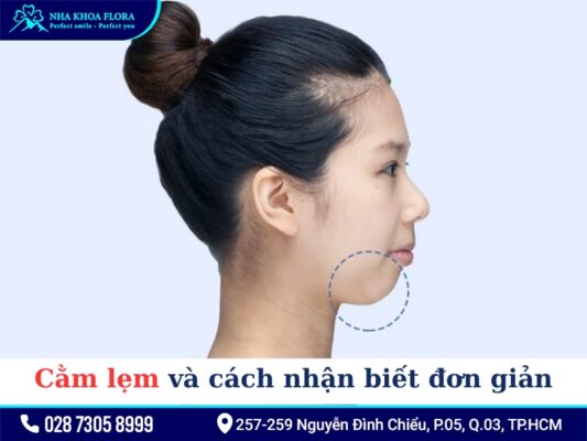 Cằm lẹm niềng răng - ảnh 1 Cằm lẹm niềng răng - ảnh 1