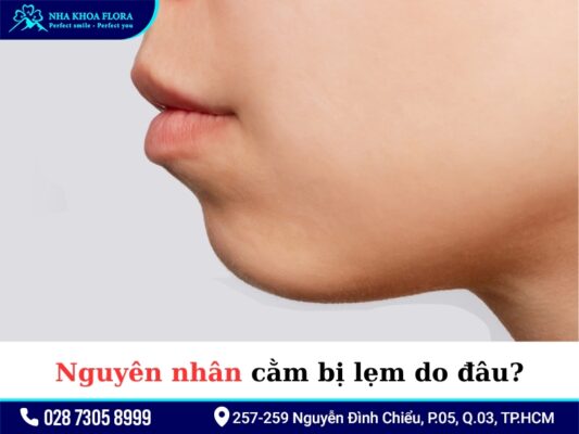 Cằm lẹm niềng răng - ảnh 2 Cằm lẹm niềng răng - ảnh 2