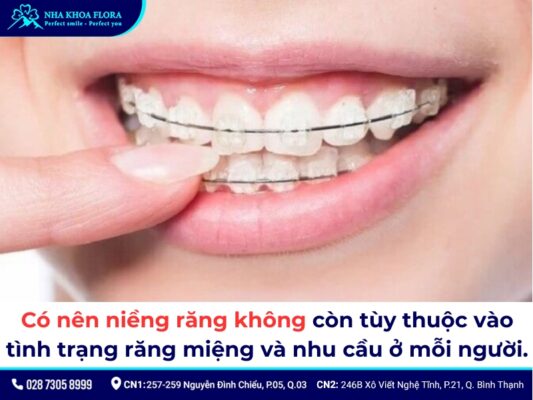 Có nên niềng răng không - ảnh 2 Có nên niềng răng không - ảnh 2
