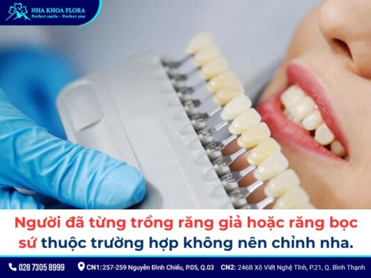 Có nên niềng răng không - ảnh 3 Có nên niềng răng không - ảnh 3