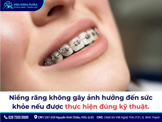 Có nên niềng răng không - ảnh 4 Có nên niềng răng không - ảnh 4