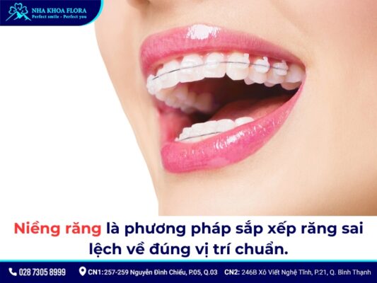 độ tuổi niềng răng - ảnh 1 độ tuổi niềng răng - ảnh 1