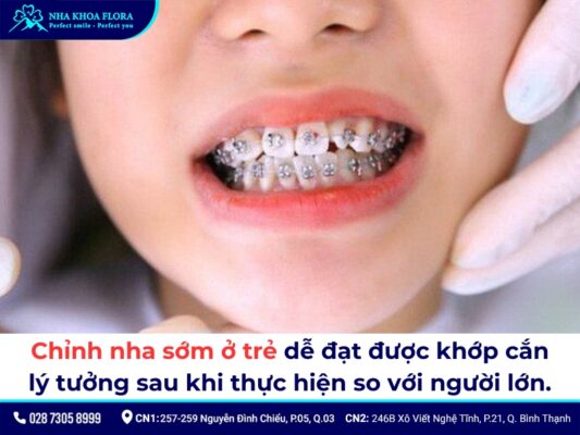 độ tuổi niềng răng - ảnh 4 độ tuổi niềng răng - ảnh 4