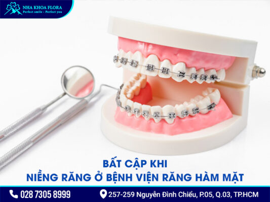 Giá niềng răng ở bệnh viện Răng hàm mặt - ảnh 3 Giá niềng răng ở bệnh viện Răng hàm mặt - ảnh 3