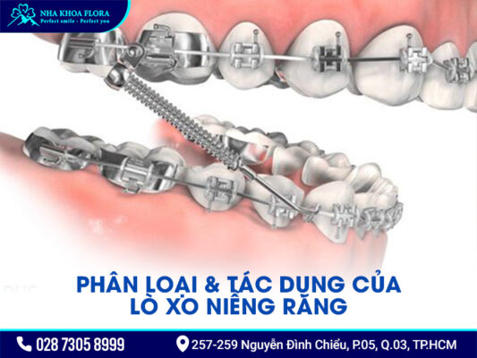 Lò xo niềng răng - ảnh 2 Lò xo niềng răng - ảnh 2