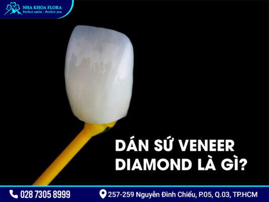 Mặt dán sứ Diamond - ảnh 1 Mặt dán sứ Diamond - ảnh 1